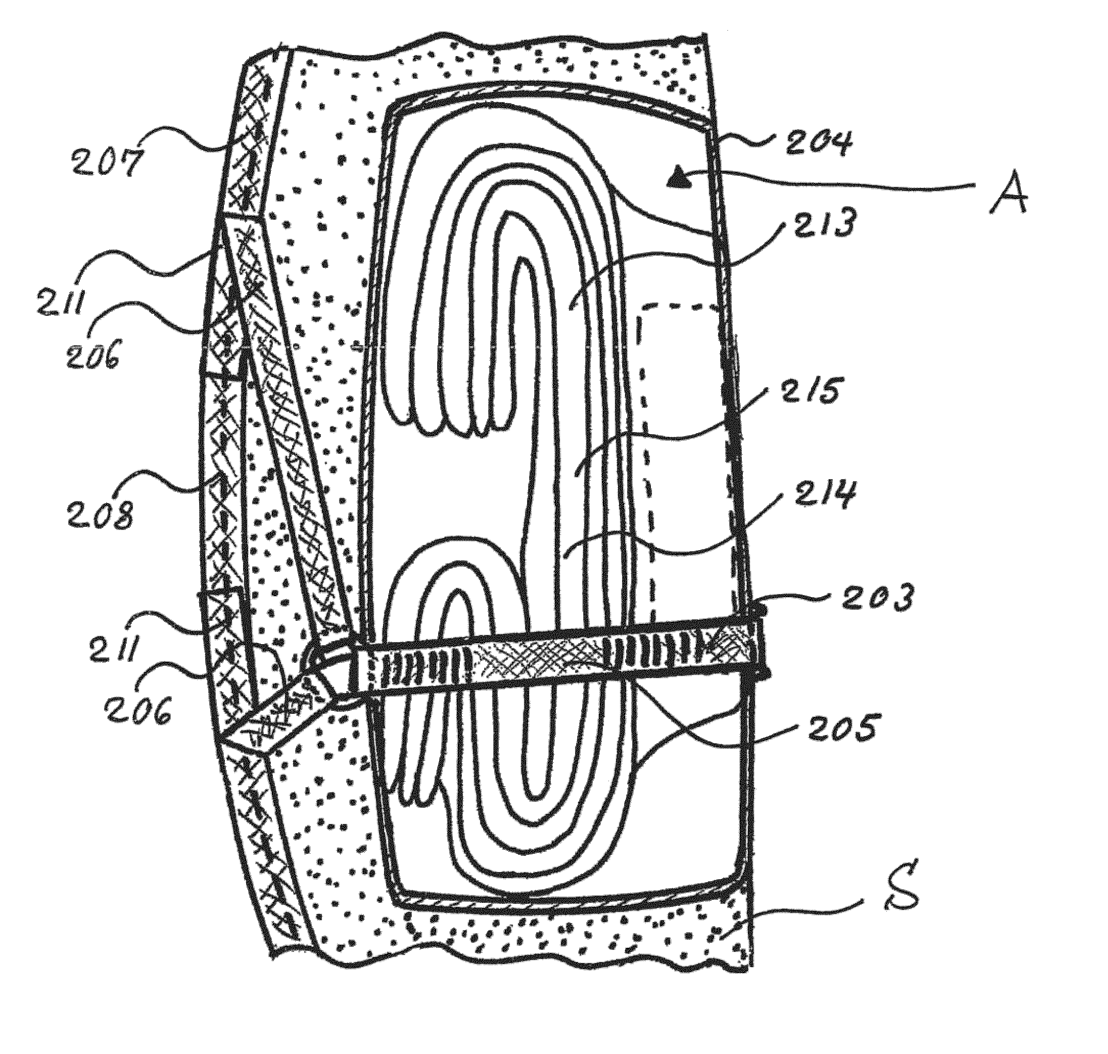 Airbag system, vehicle seat comprising an airbag system, and deployment for an airbag system