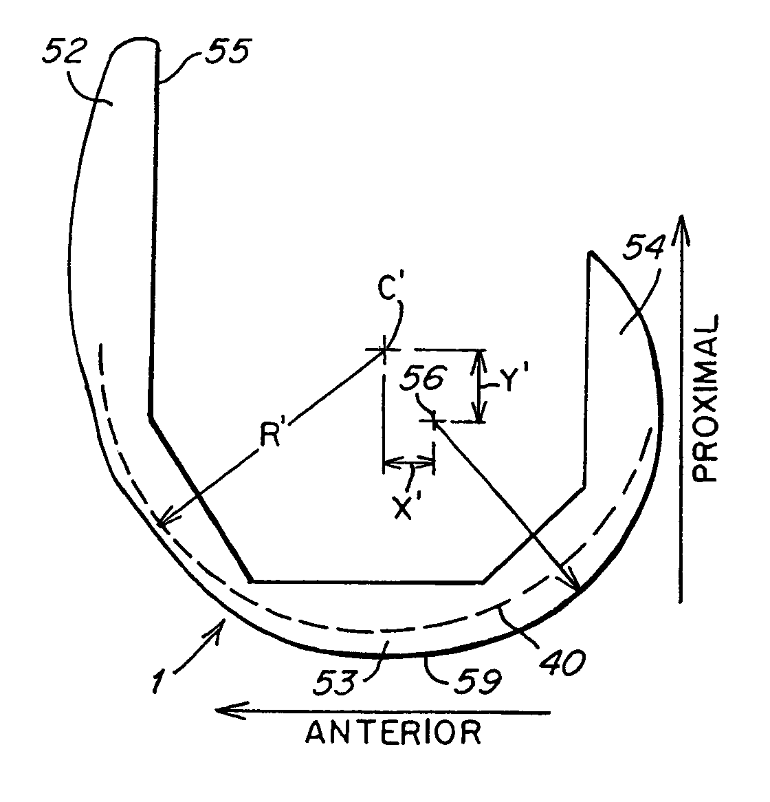 Knee joint prosthesis with a femoral component which links the tibiofemoral axis of rotation with the patellofemoral axis of rotation