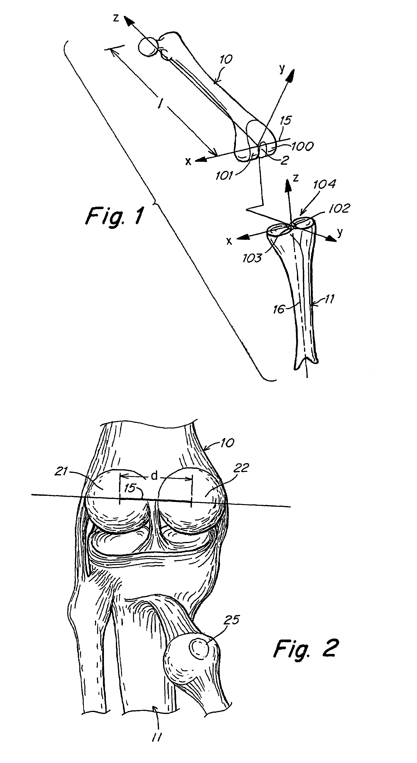 Knee joint prosthesis with a femoral component which links the tibiofemoral axis of rotation with the patellofemoral axis of rotation