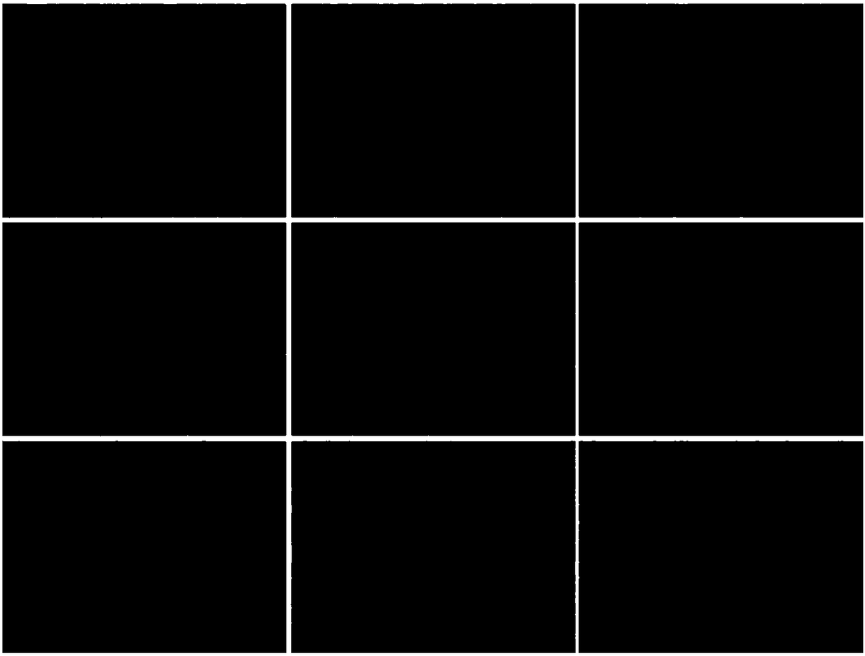 Sipunculid peptide and application thereof to preparation of gestational period hypertension treatment medicine