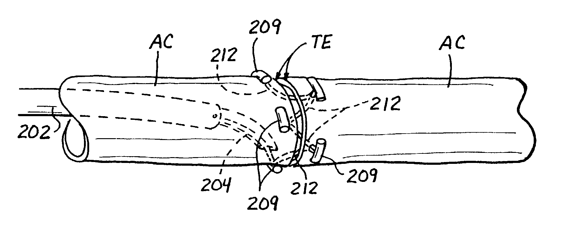 Transluminal methods and devices for closing, forming attachments to, and/or forming anastomotic junctions in, luminal anatomical structures