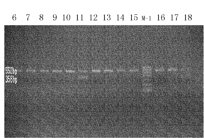 PCR (Polymerase Chain Reaction) method for sex appraisal of Nipponia nippon