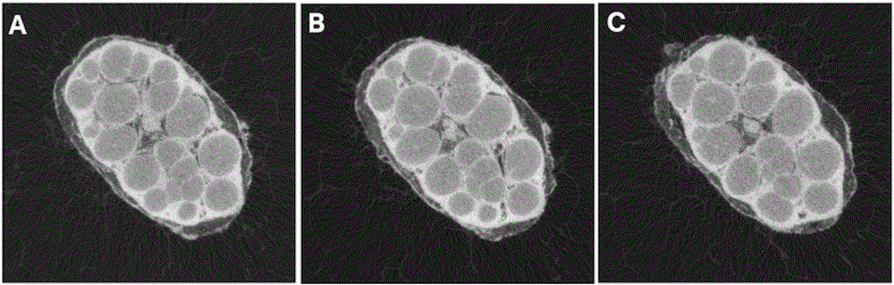 Method for increasing definition of Micro CT of peripheral nerve image