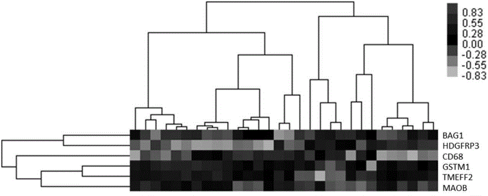 Genes for prognosis of triple negative breast cancer and application thereof