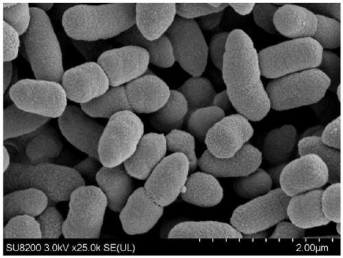 Trehalase production strain and application thereof