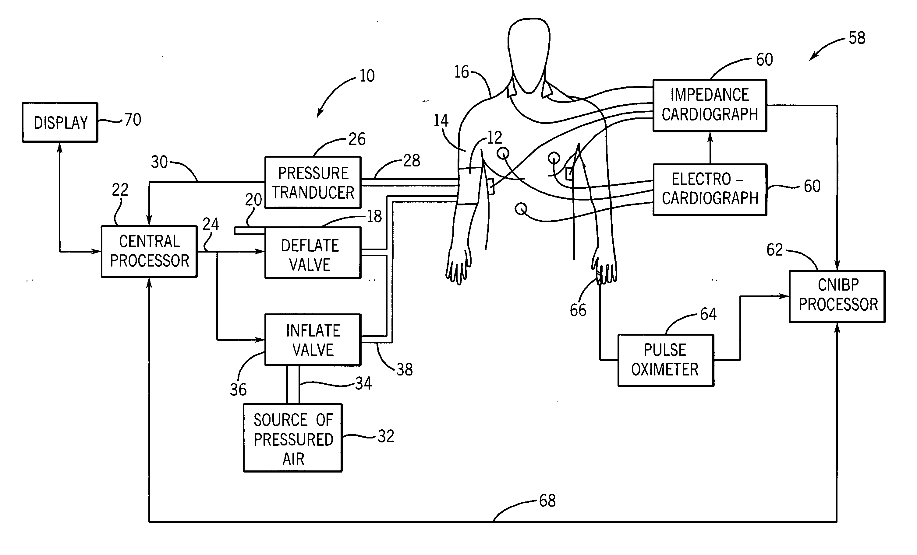 Non-invasive blood pressure monitor with improved performance