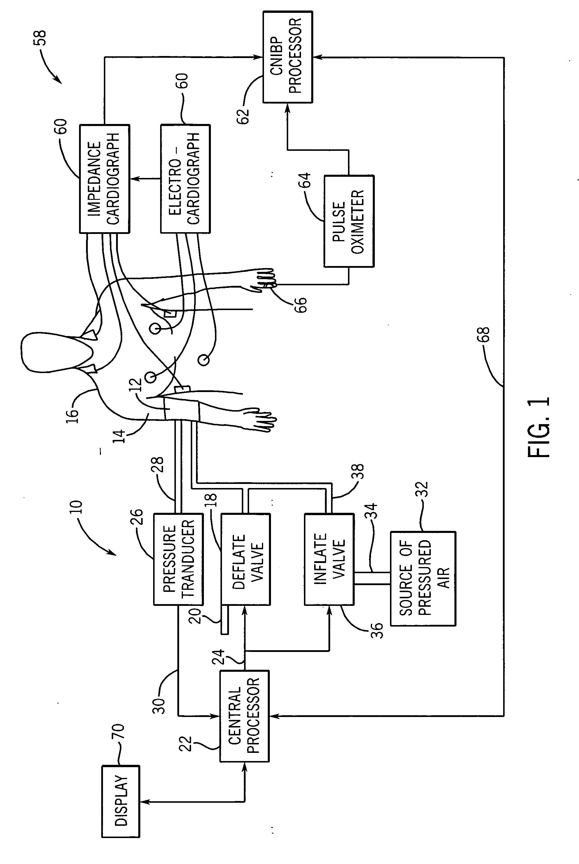 Non-invasive blood pressure monitor with improved performance