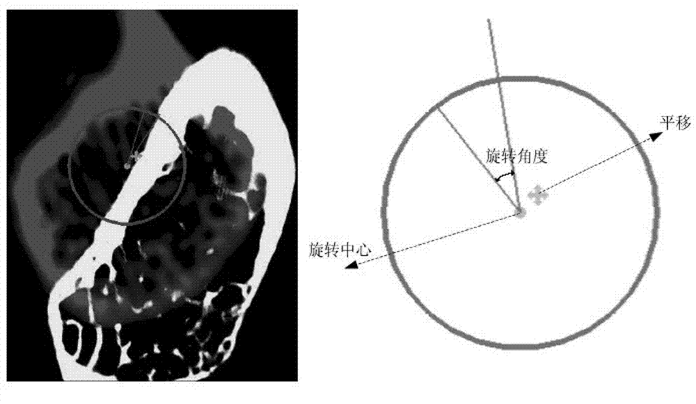 Method and equipment for interactively registering medical three-dimensional image