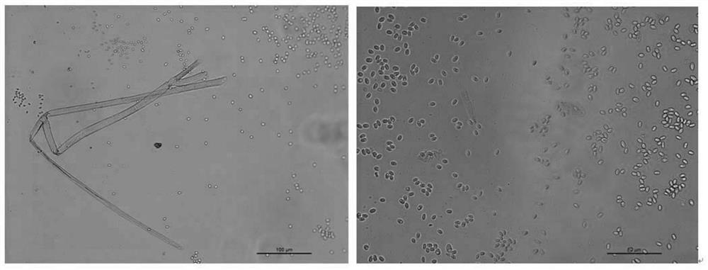 A kind of symbiotic fungus m2-1 of Pleurotus chinensis and its bacterial agent and fermentation liquid extract