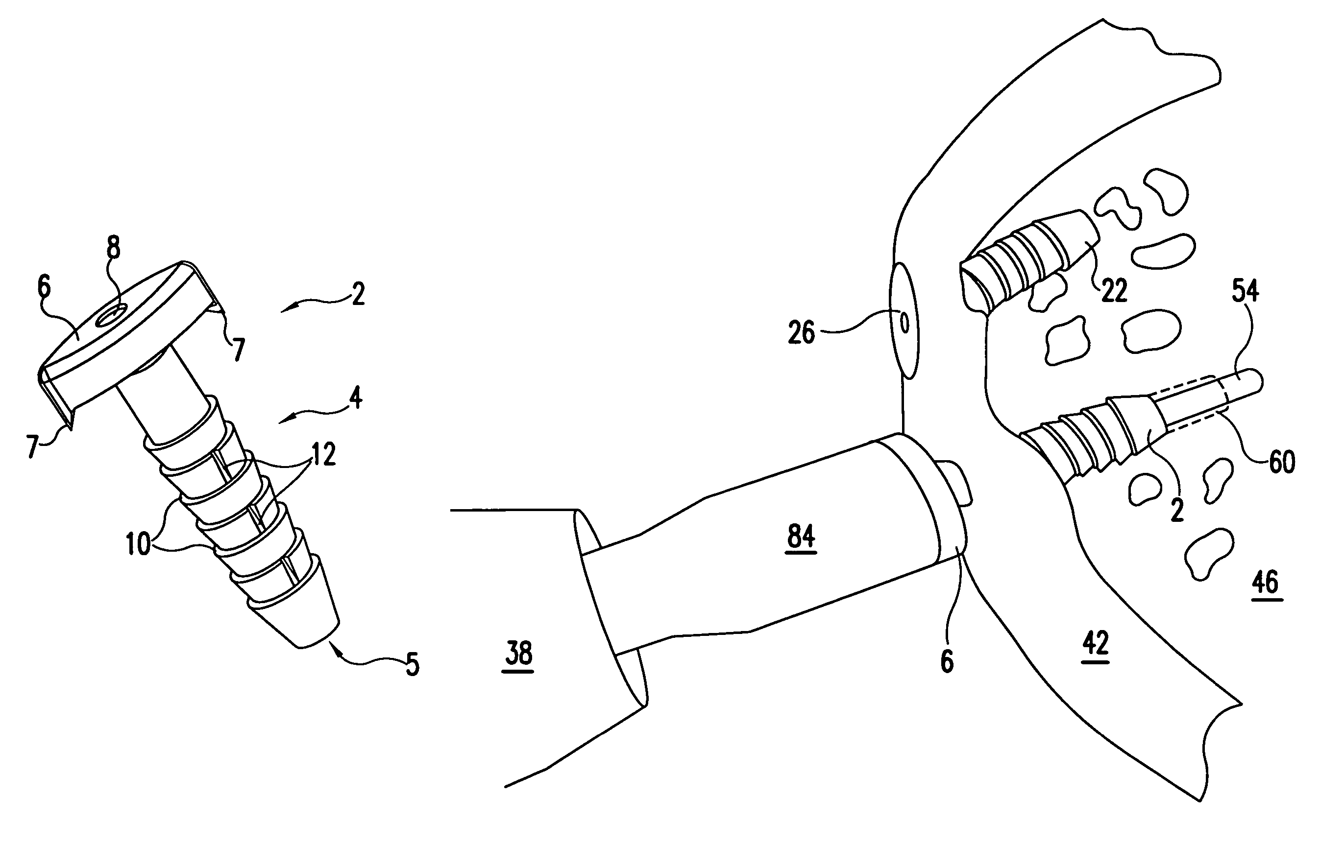 Bioabsorbable tissue tack with oval-shaped head and method of tissue fixation using the same