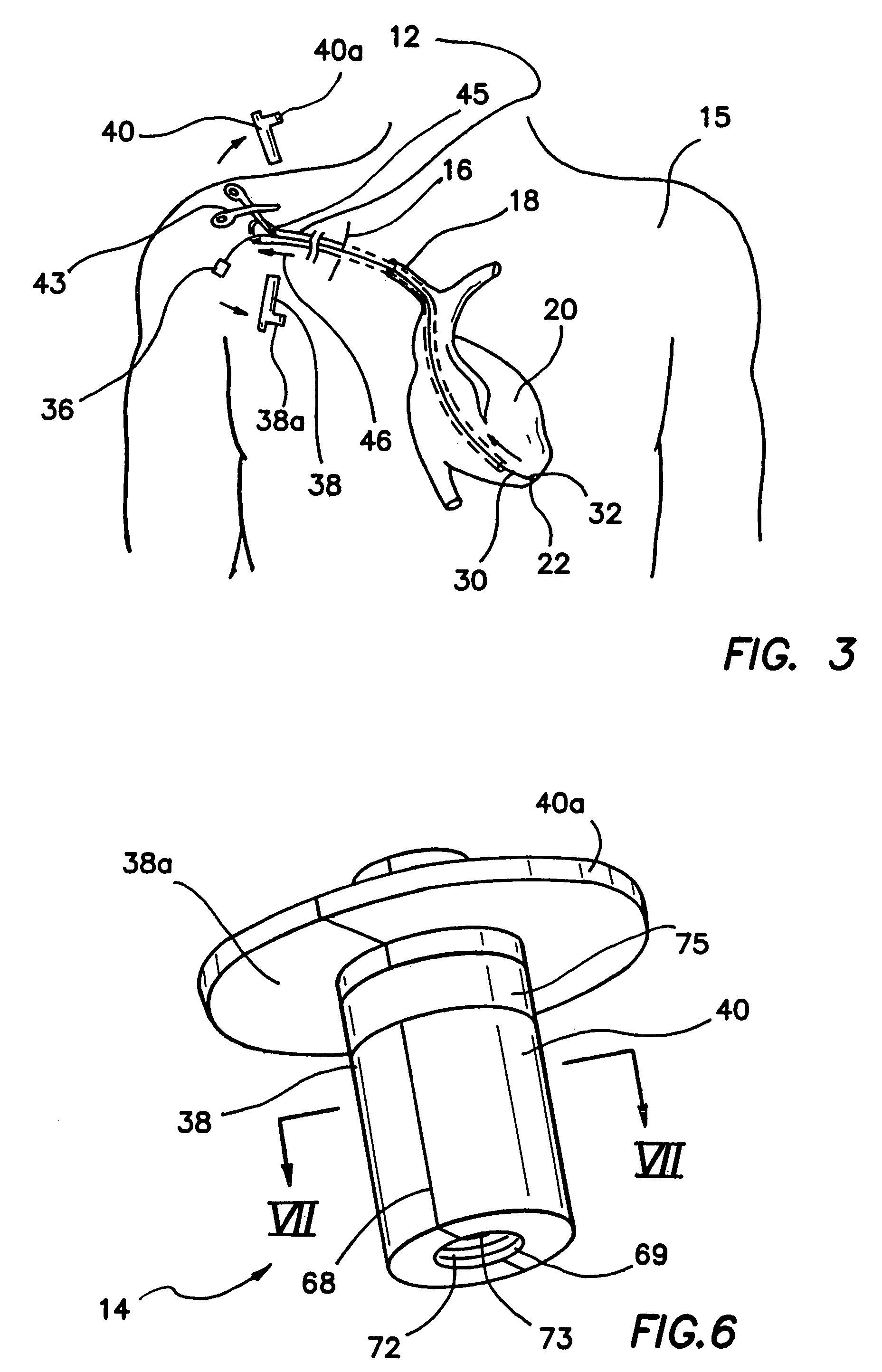 Introducer and hemostatic valve combination and method of using the same