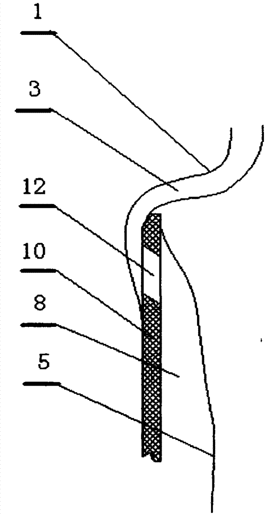 Packaging container with elastic inner bag