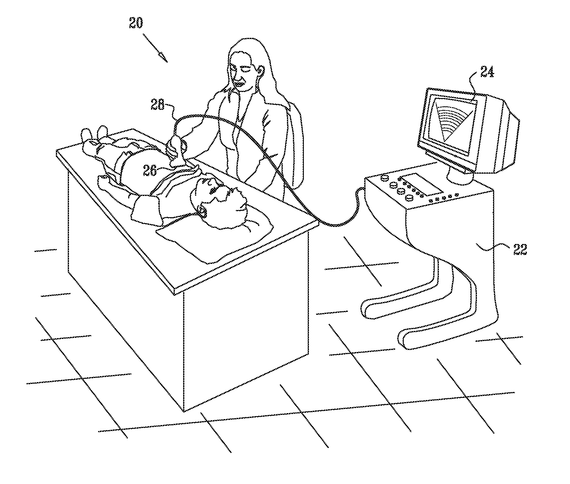 Clutter suppression in ultrasonic imaging systems