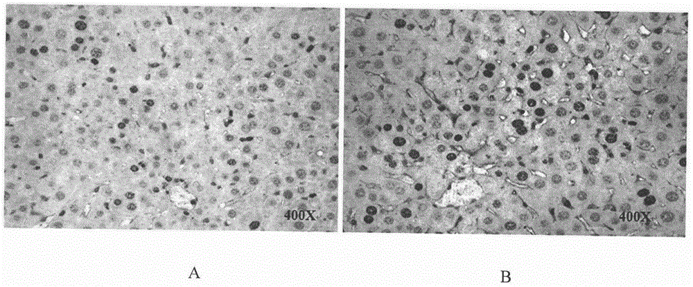 Therapeutical agent for liver regeneration