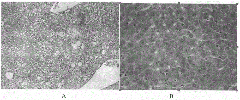 Therapeutical agent for liver regeneration