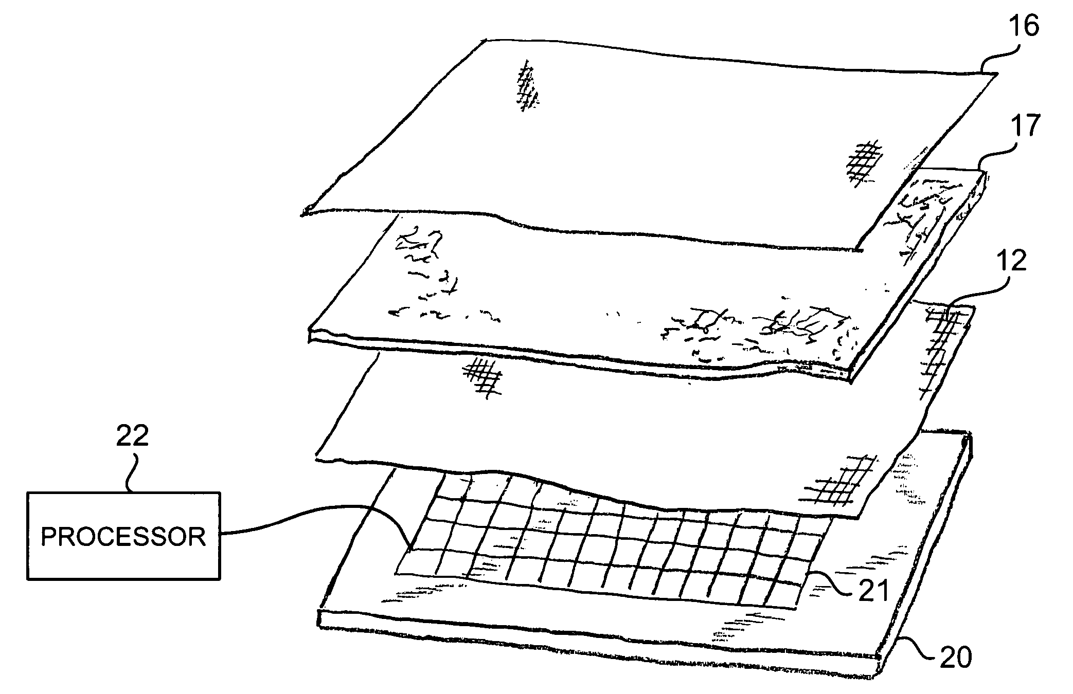 Devices for prevention of pressure ulcers