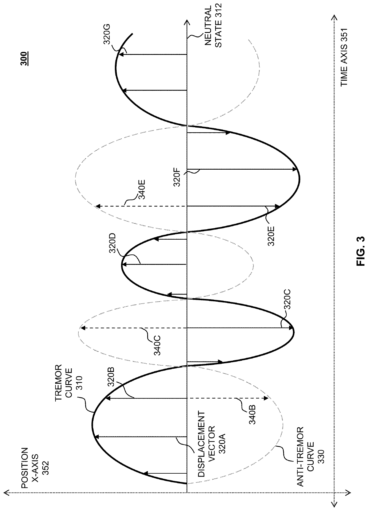 Tremor detecting and rendering in virtual reality