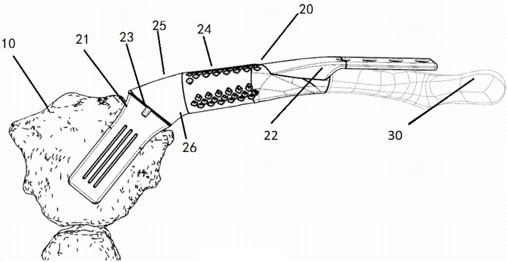 Proximal clavicular anatomical prosthesis and forming method