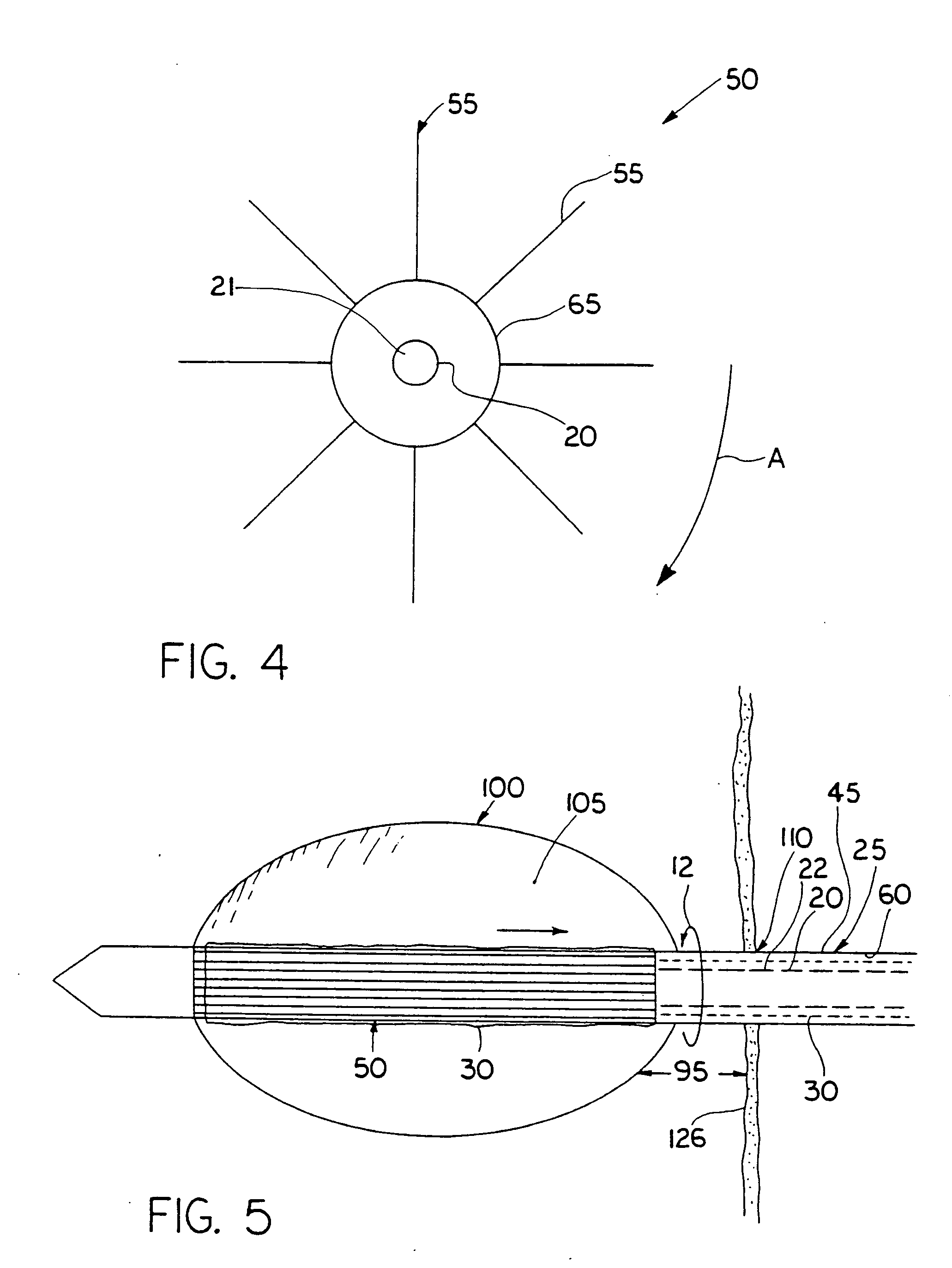 Breast surgery method and apparatus