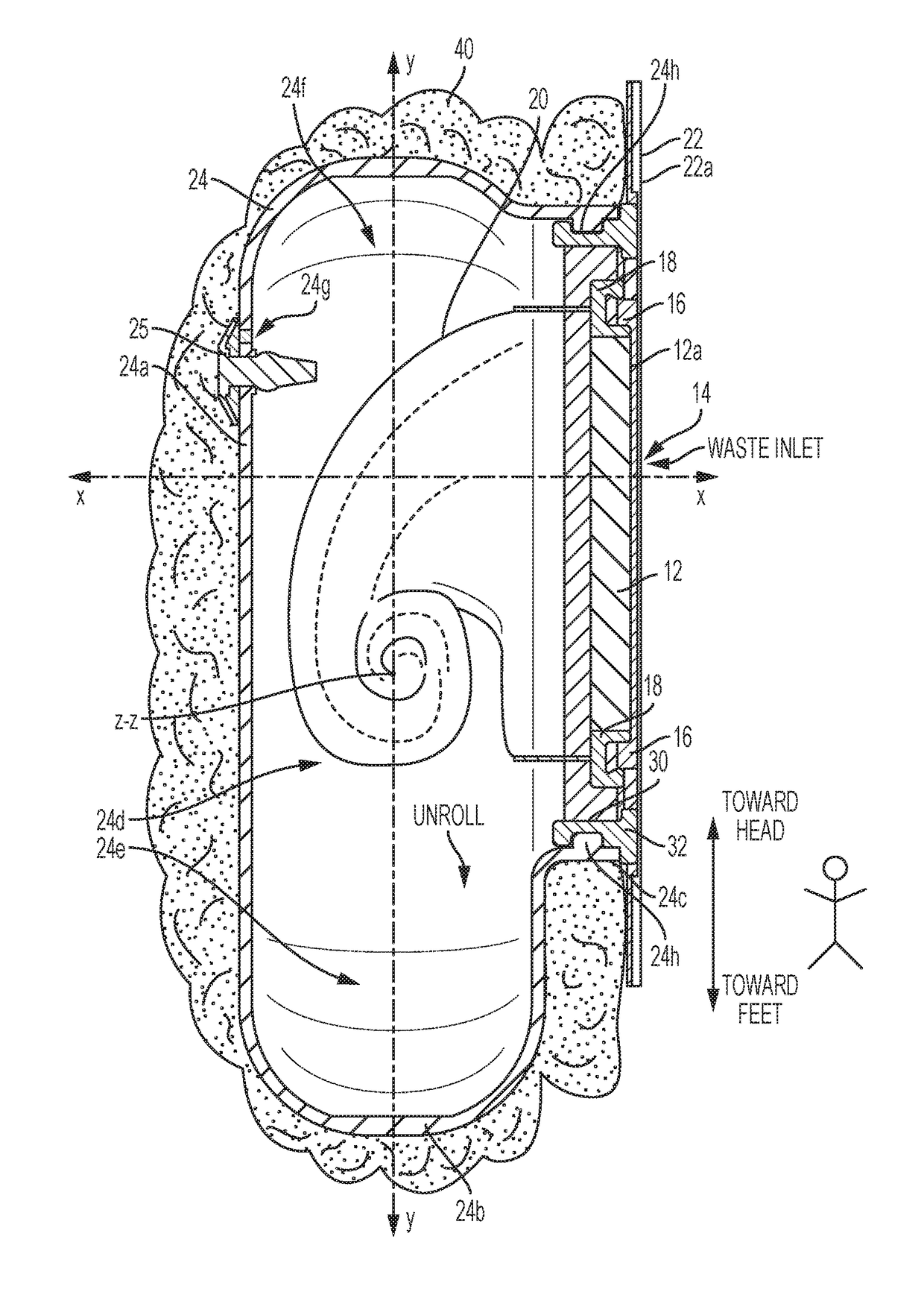 Ostomy appliance