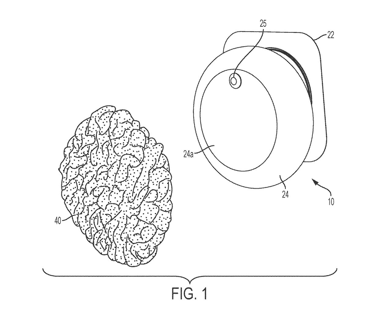 Ostomy appliance