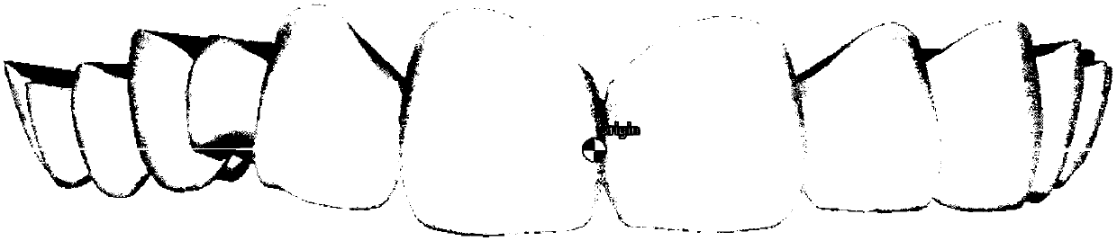 Method for generating virtual gums based on tooth model feature points