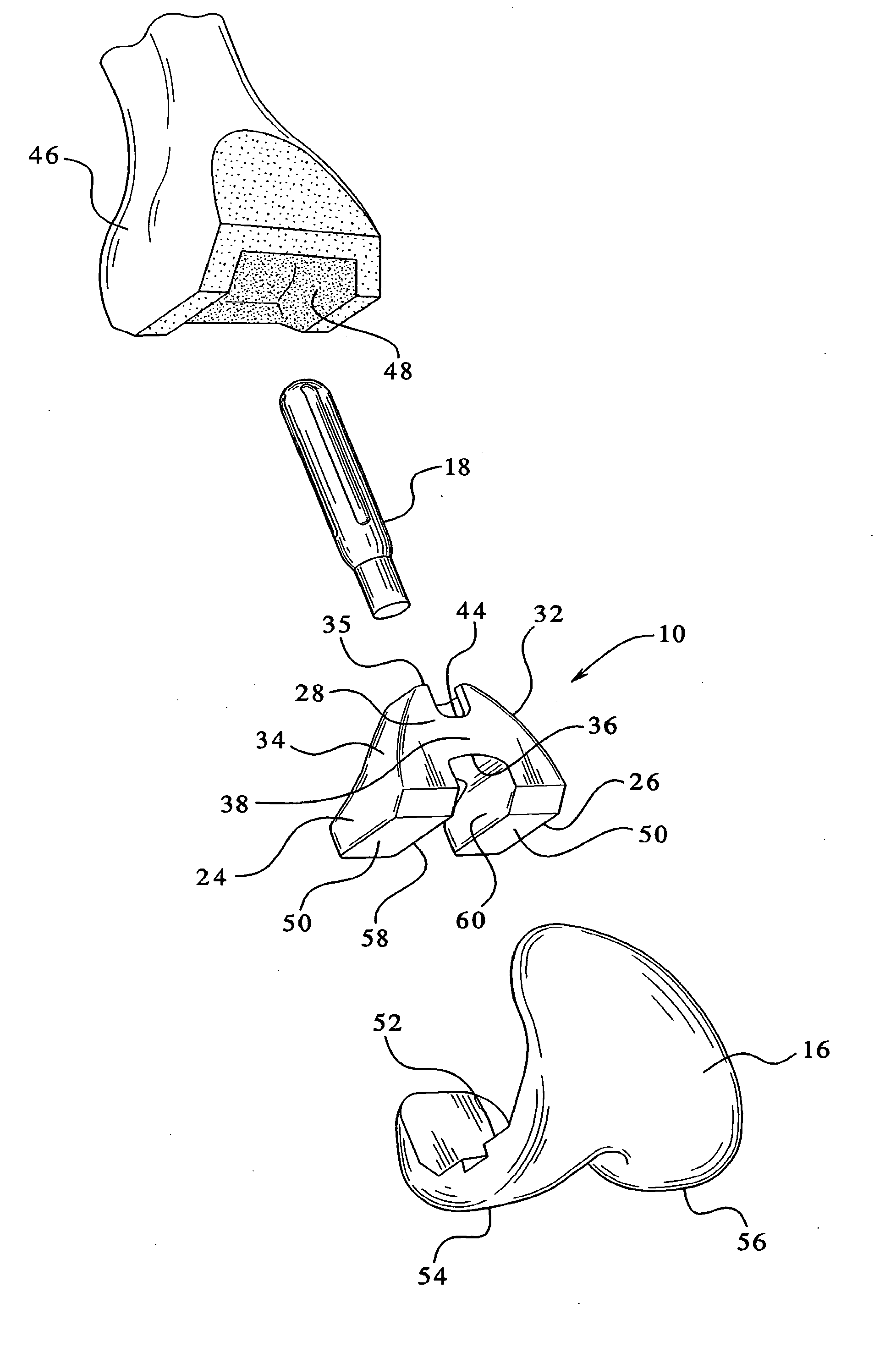 Femoral augments for use with knee joint prosthesis