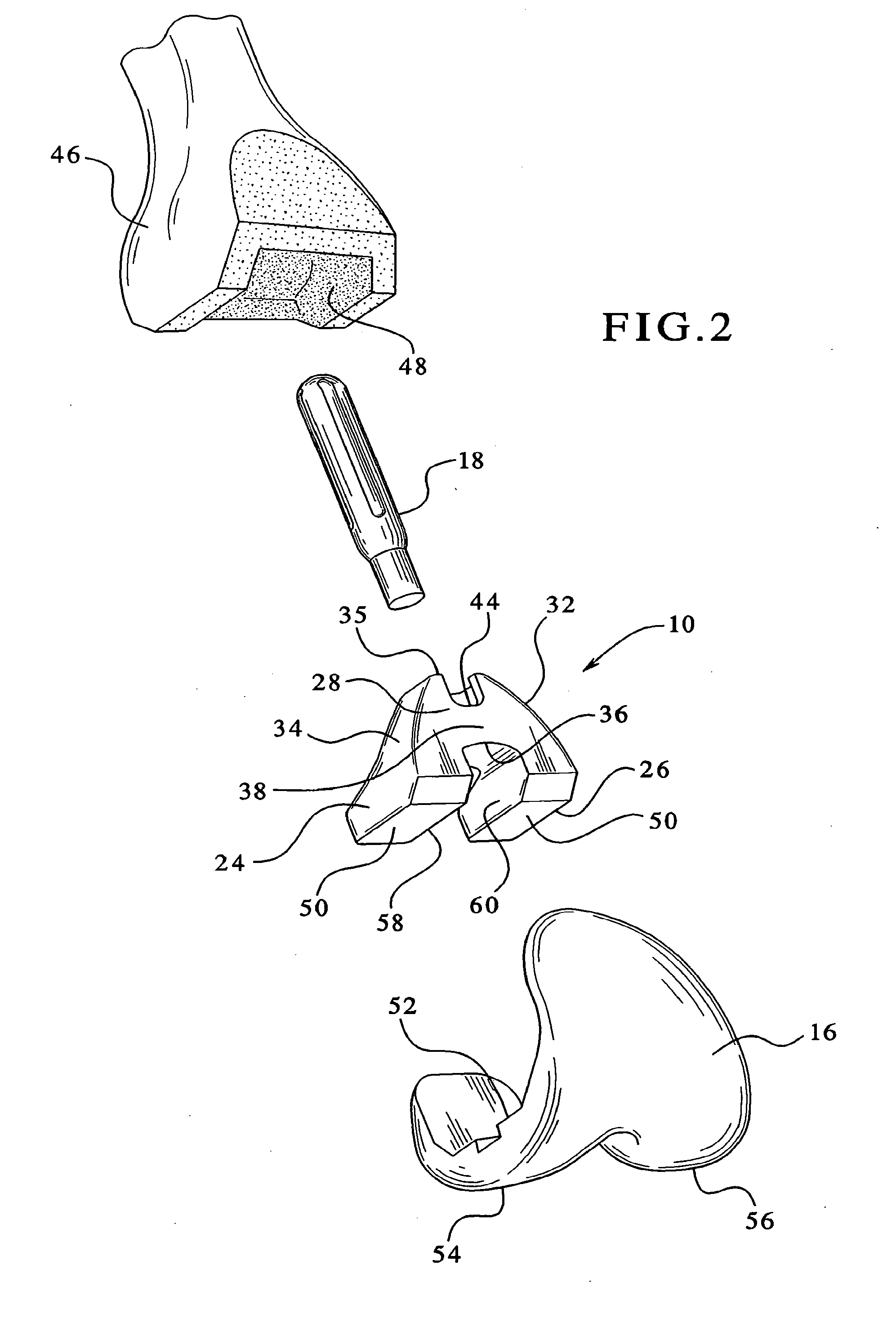 Femoral augments for use with knee joint prosthesis