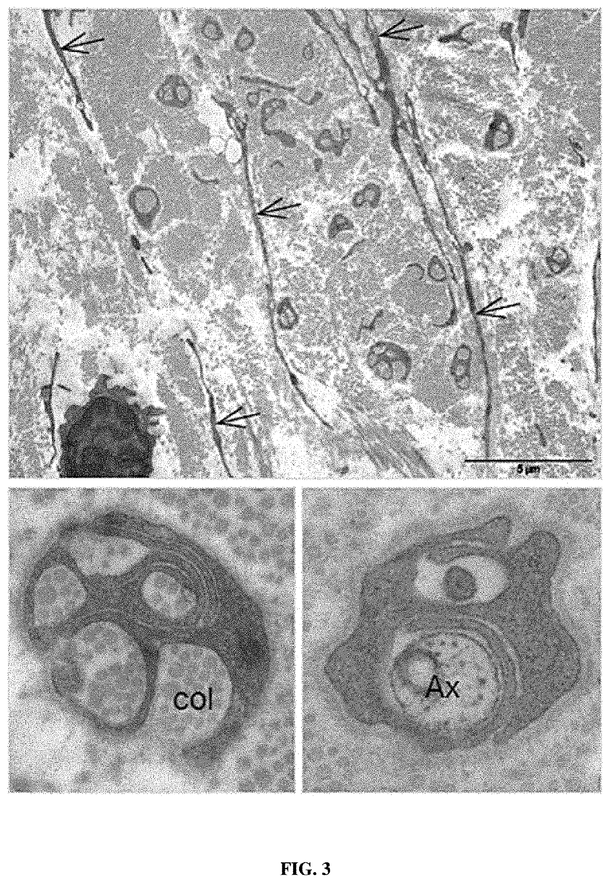 Non-human model for neurofibromatosis type 1