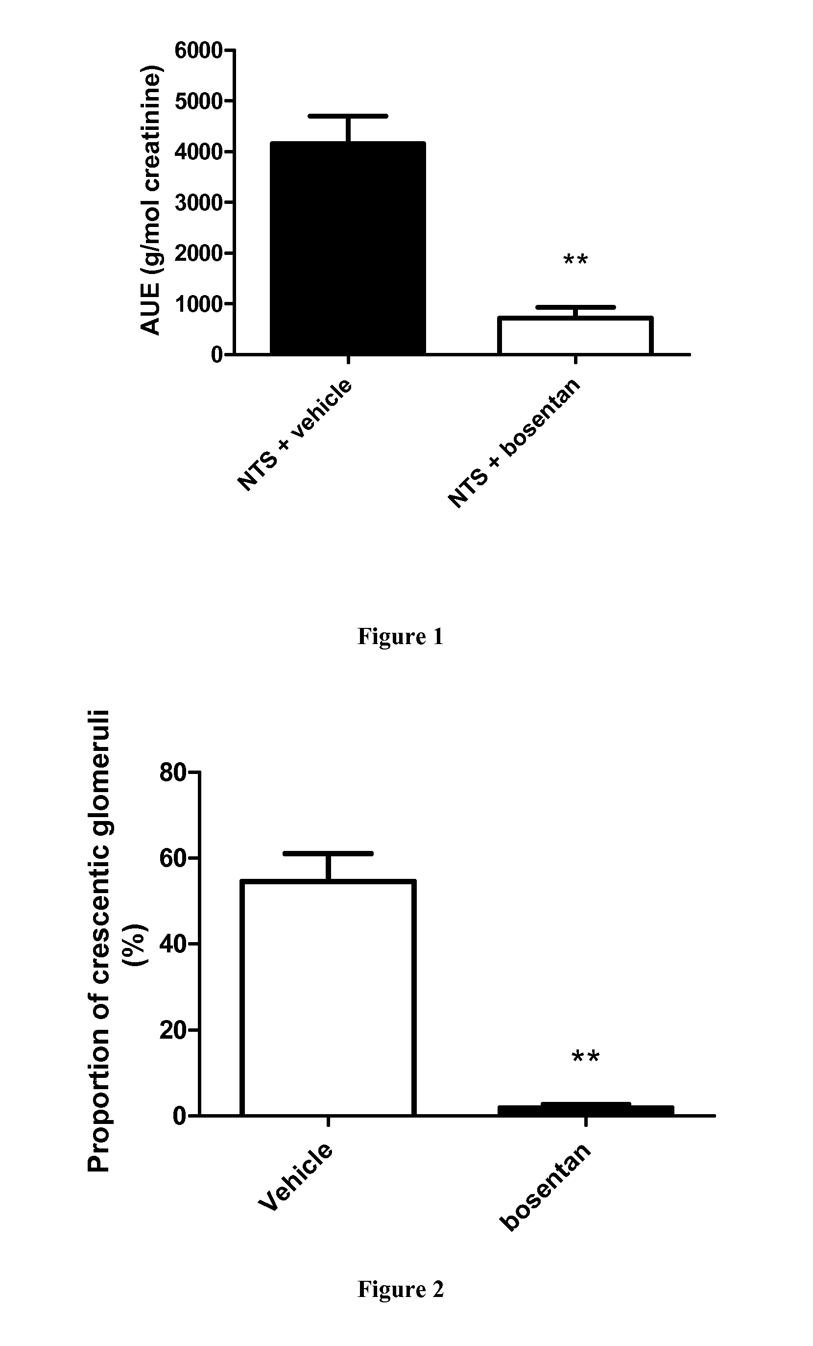 Endothelin inhibitors for the treatment of rapidly progressive glomerulonephritis