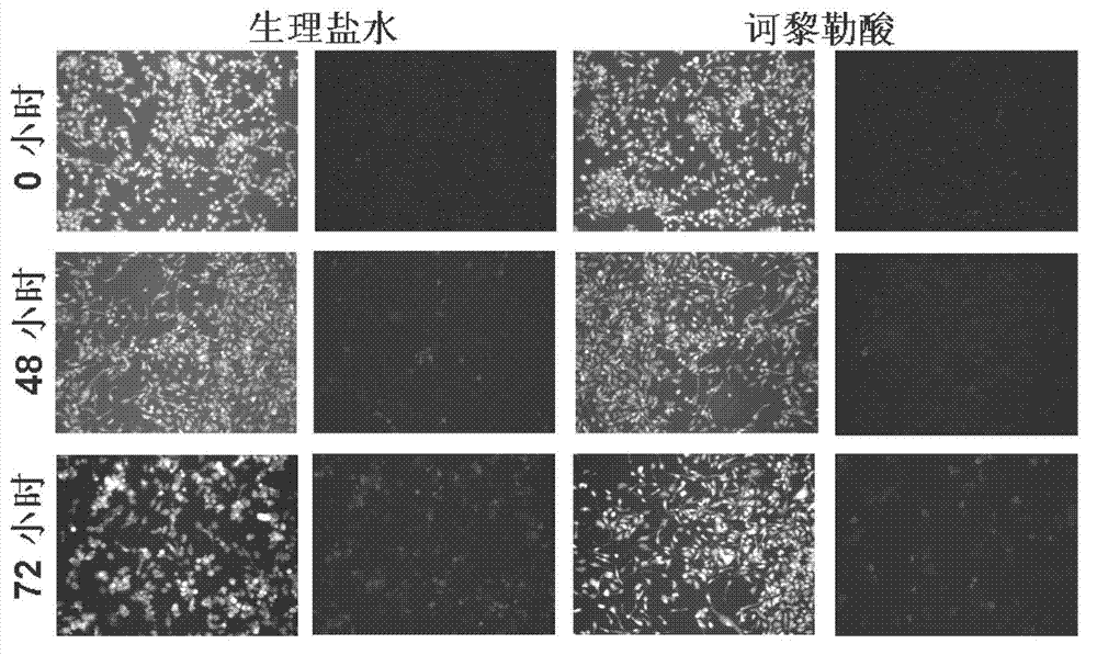 Application of chebulagic acid in preparation of medicament for treating diseases resulted from human enterovirus type 71 infection