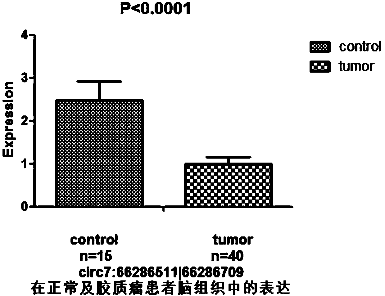 Glioma prognostic marker circ7:66286511|66286709 and applications