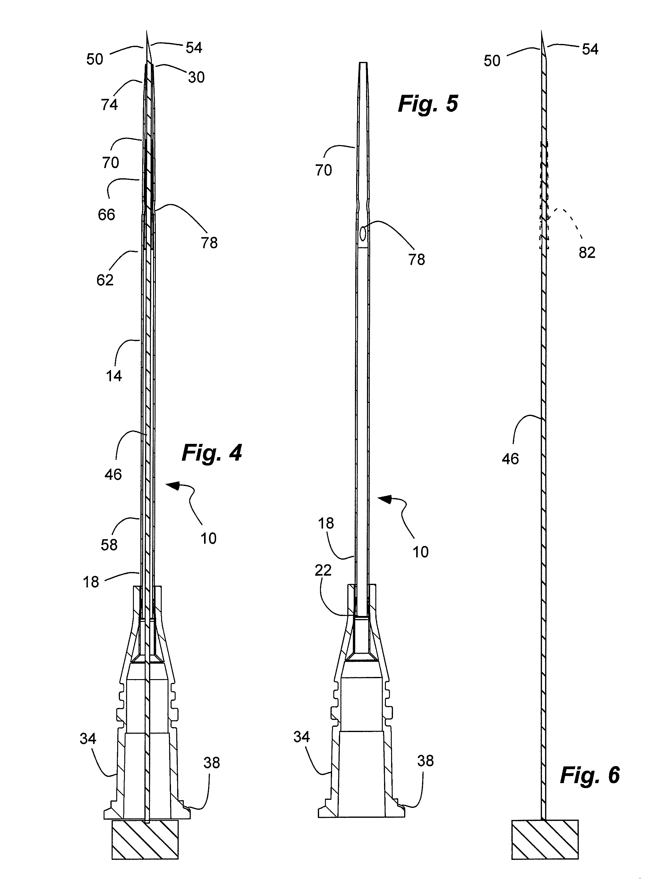 High-flow tapered peripheral iv catheter with side outlets