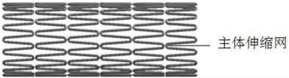 Transforaminal nanometer-bioglass-coating minimally-invasive fusing device