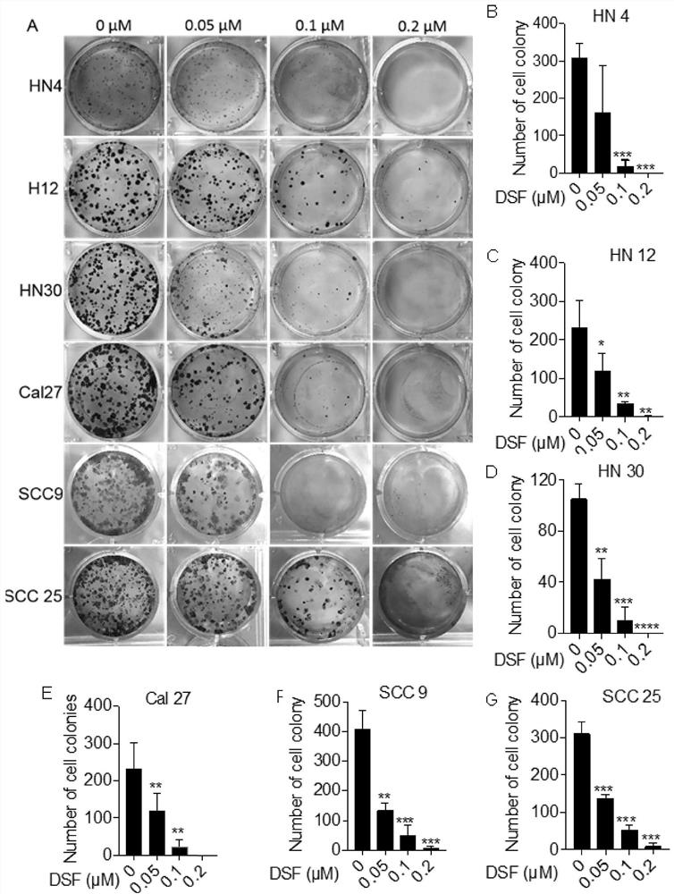 Application of disulfiram in preparation of drugs capable of resisting head and neck cancer and fibrosis