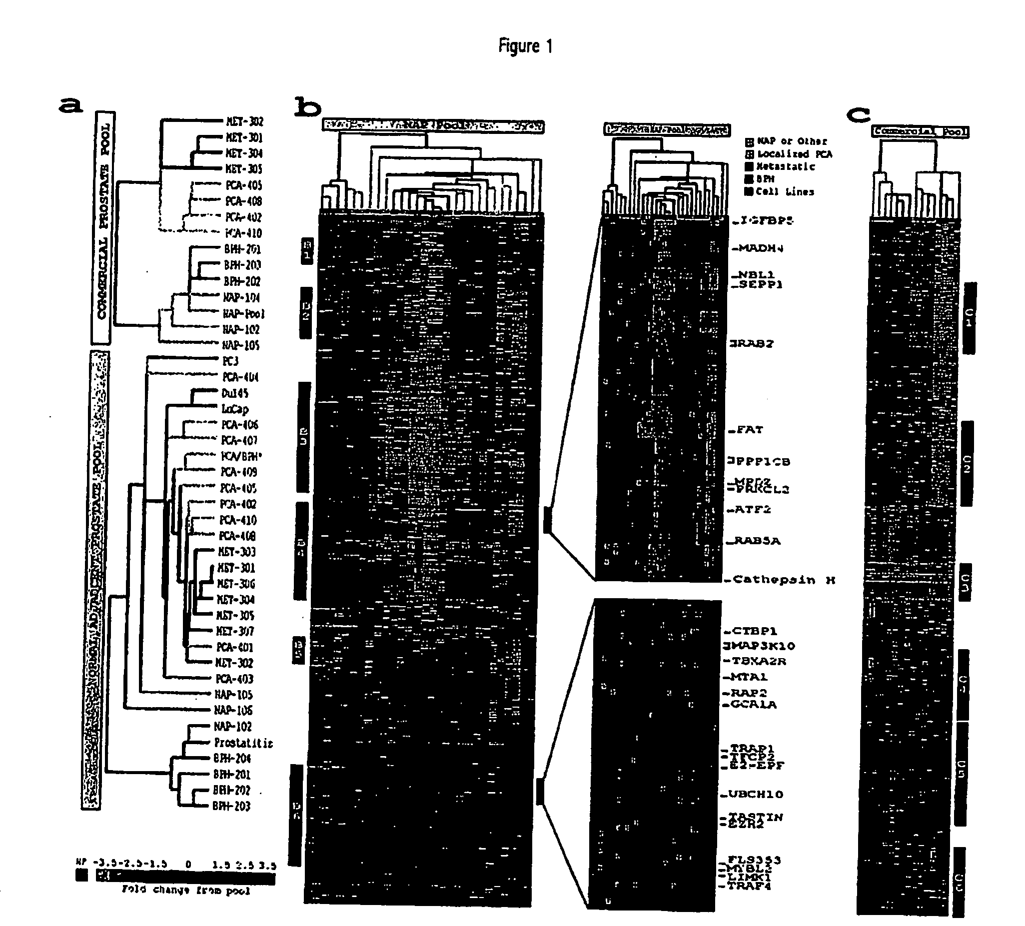 Expression Profile Of Prostate Cancer