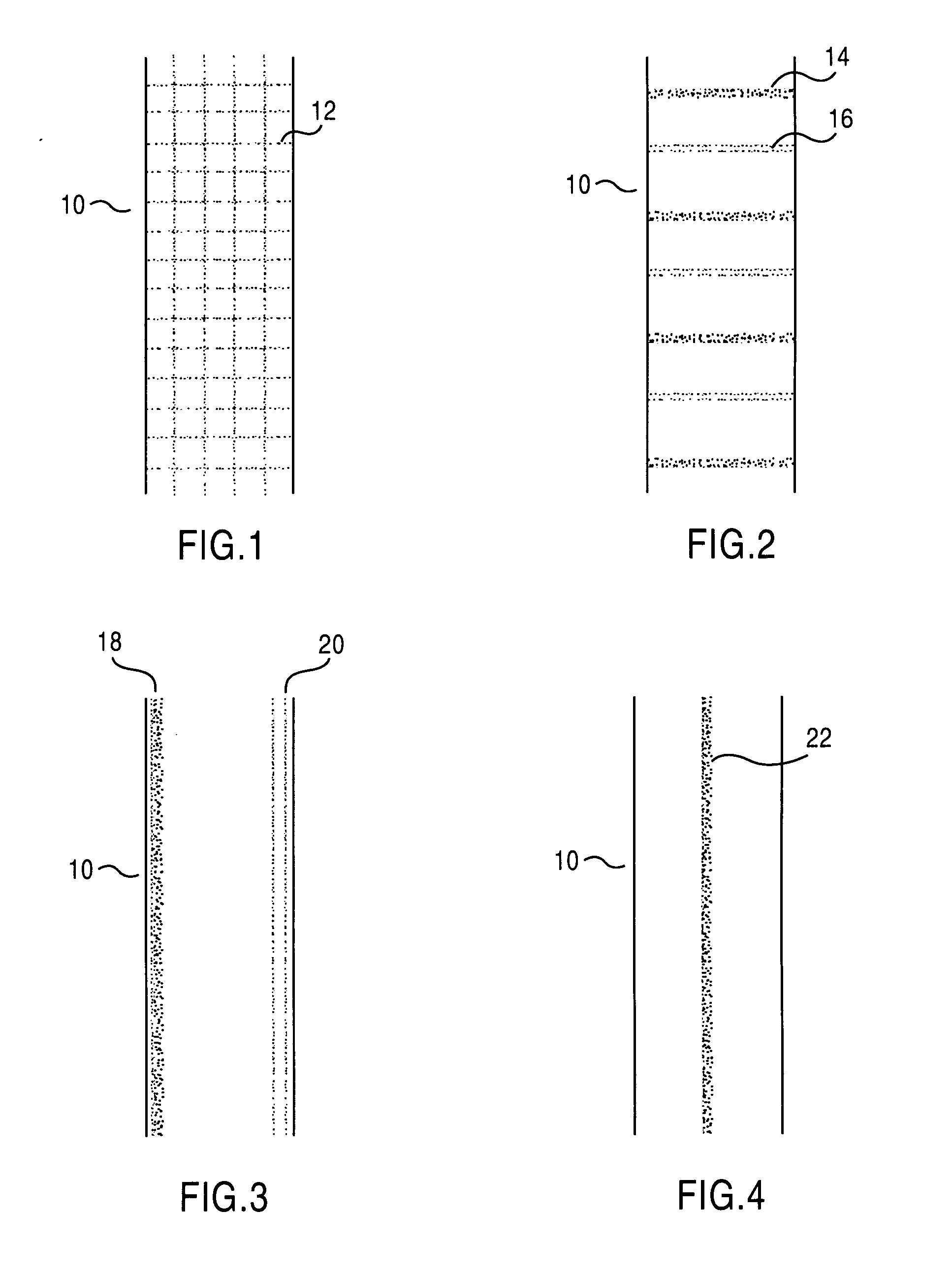 Patterning on surface with high thermal conductivity materials