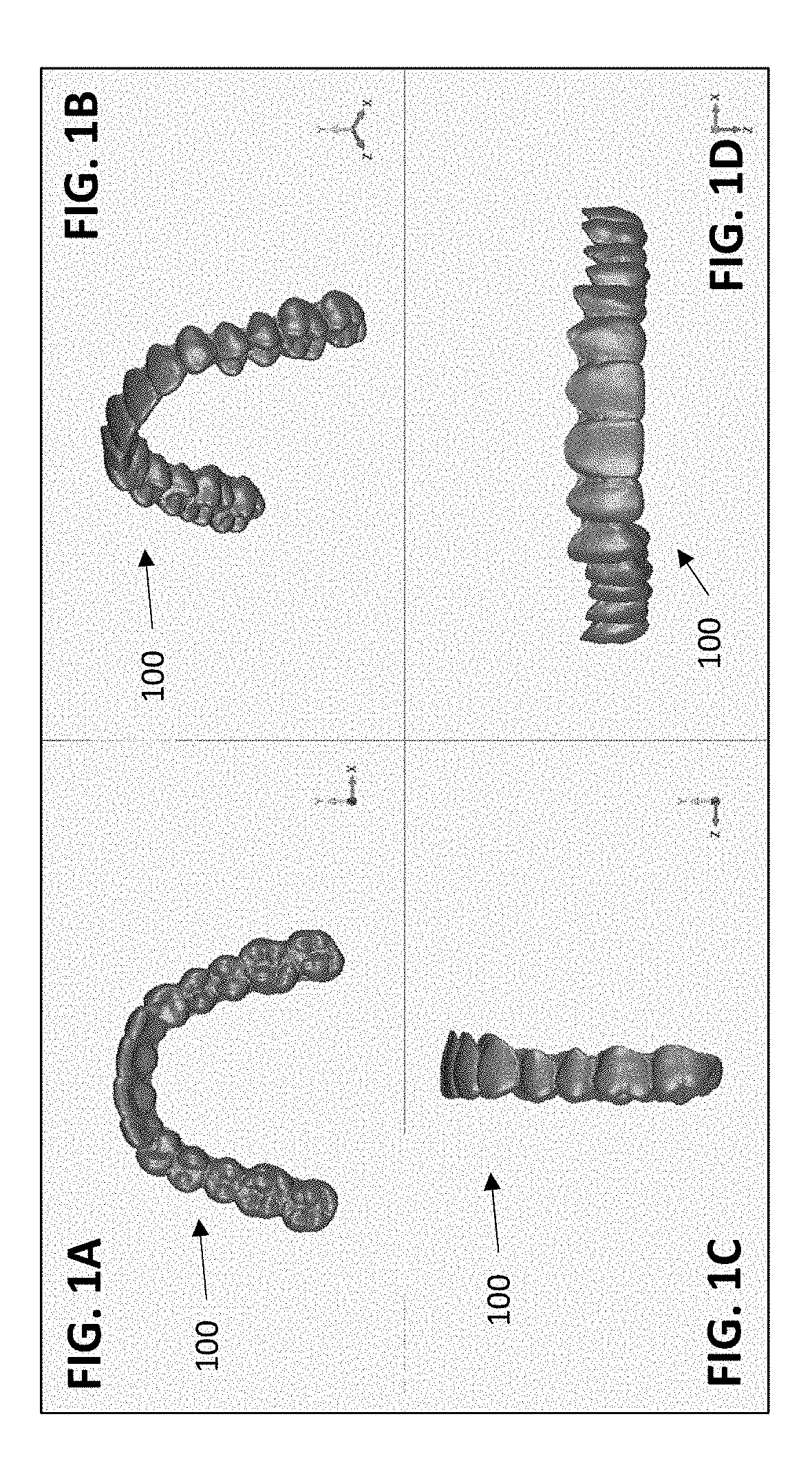 Orthodontic retainers