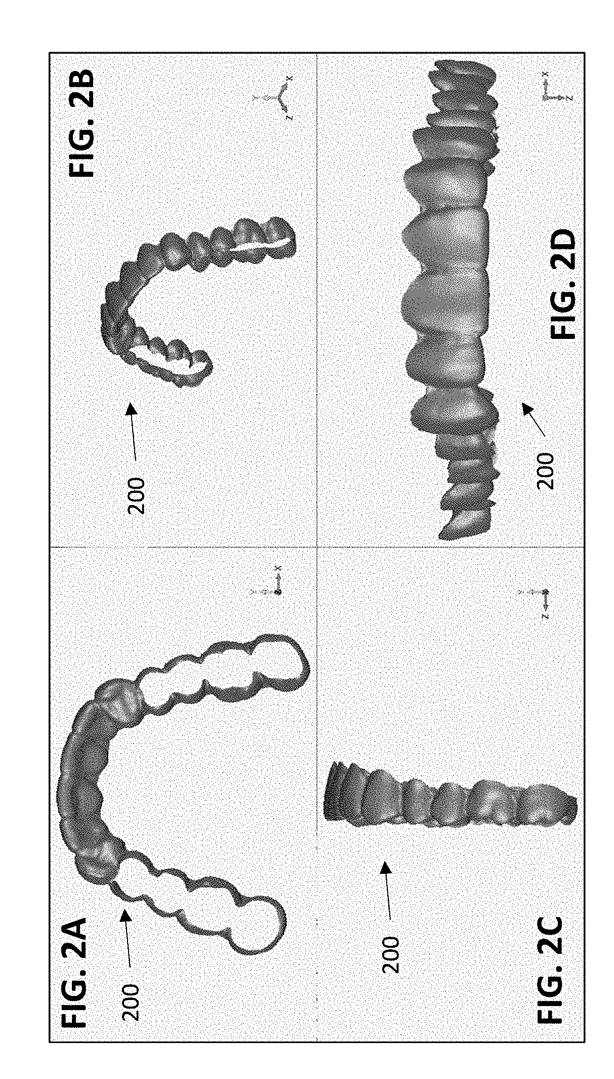 Orthodontic retainers