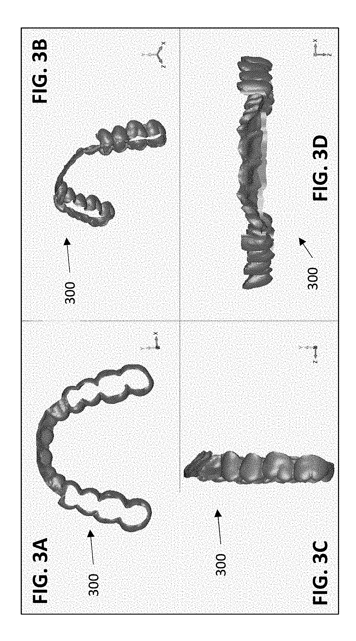 Orthodontic retainers