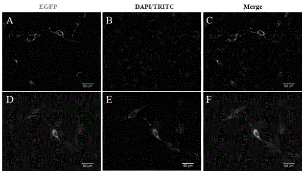 Gene application in inhibition and apoptosis of glioma cell