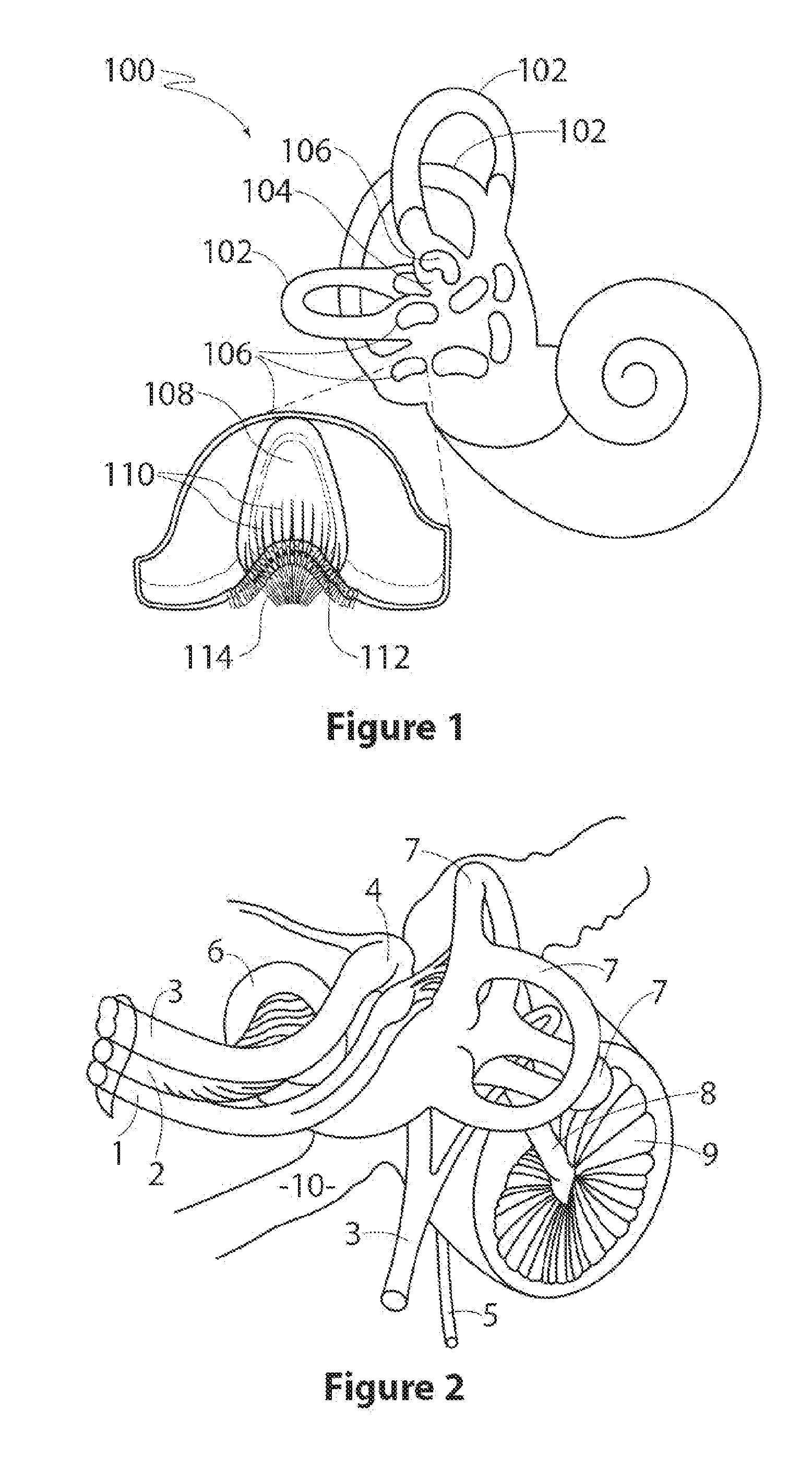 Vestibular stimulation device