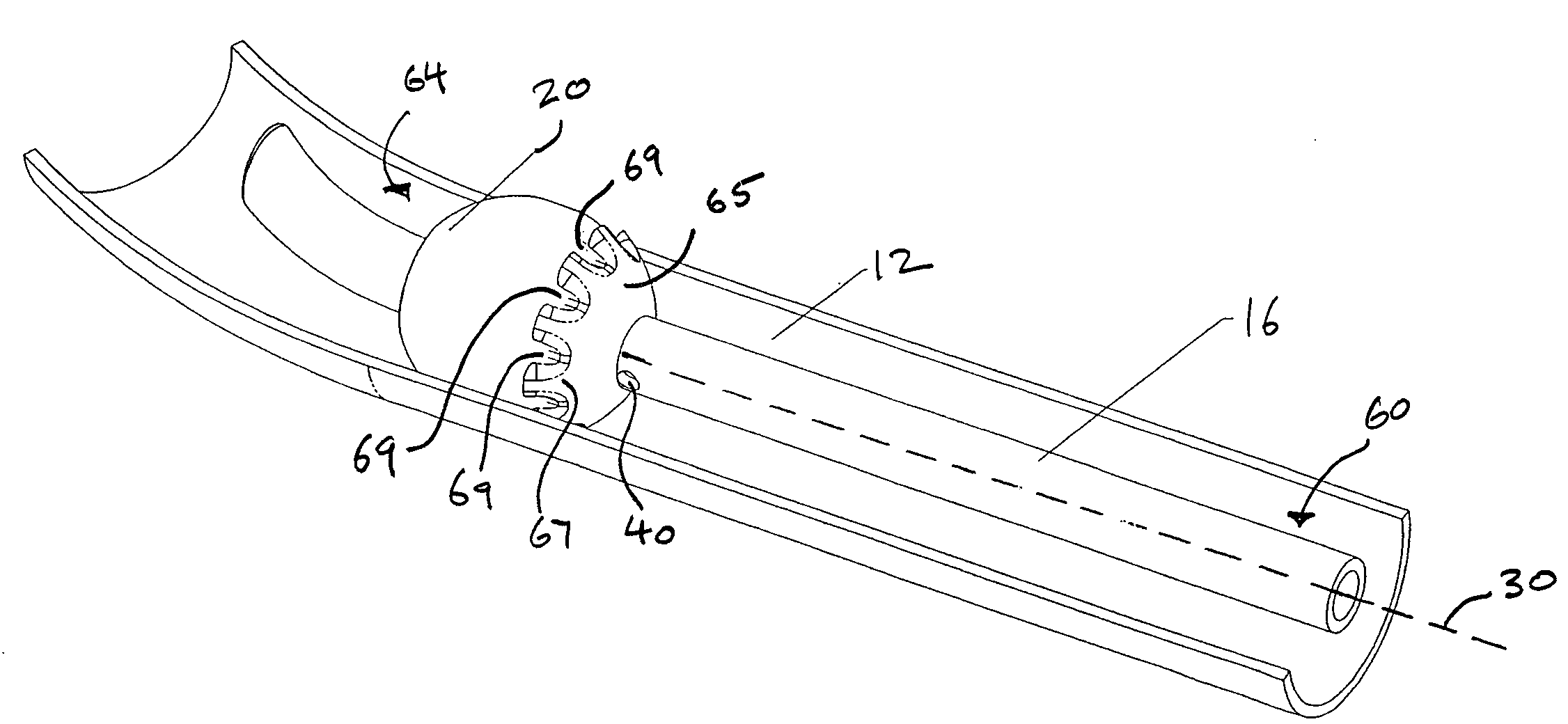 High surface area anti-microbial coated endotracheal tube