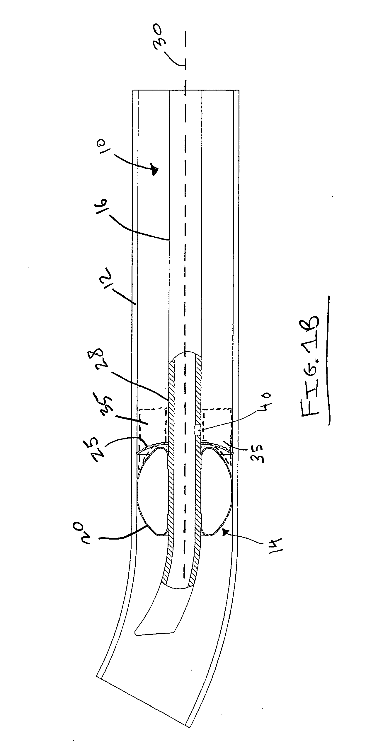 High surface area anti-microbial coated endotracheal tube