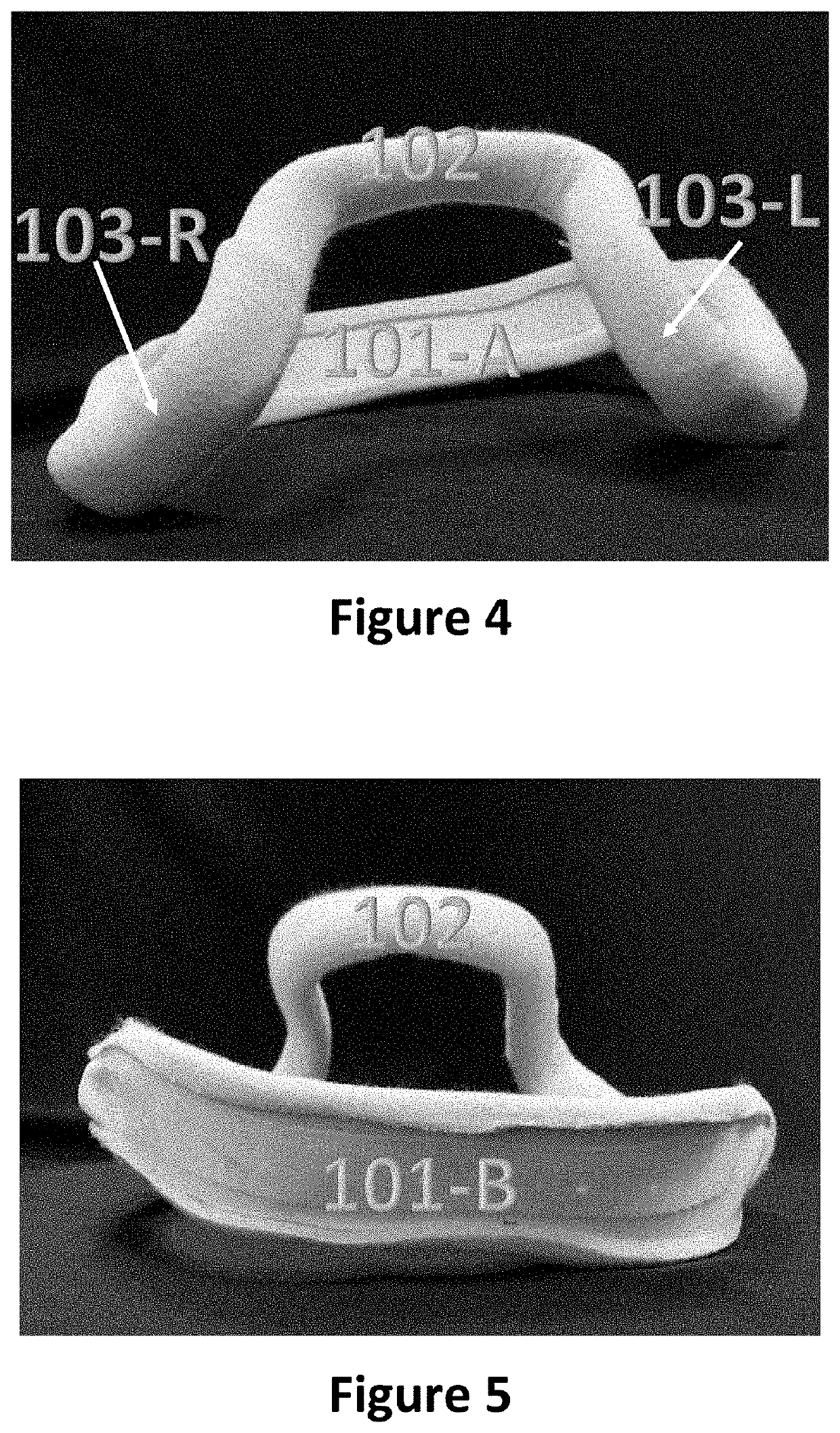 Pediatric lithotomy positioning splint