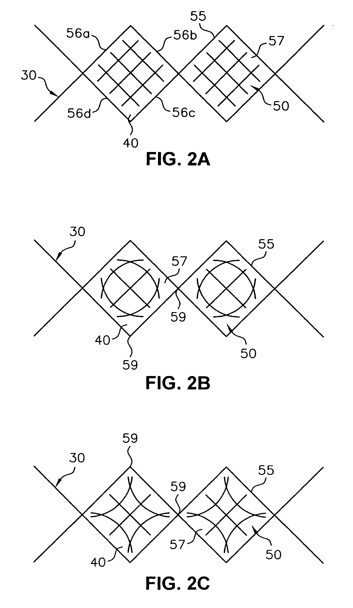 Endoluminal device and system and method for detecting a change in pressure differential across an endoluminal device