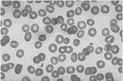 Cell separation method