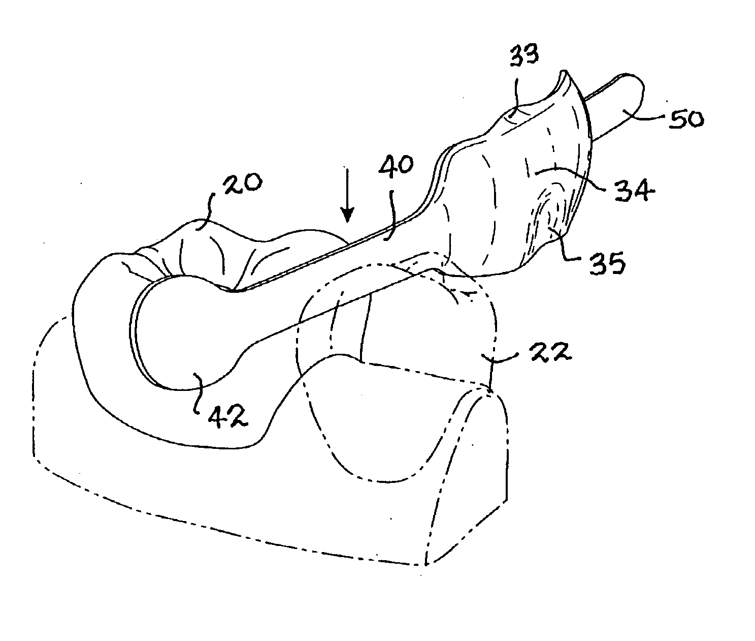 Dental matrix for a class II, III or IV restoration