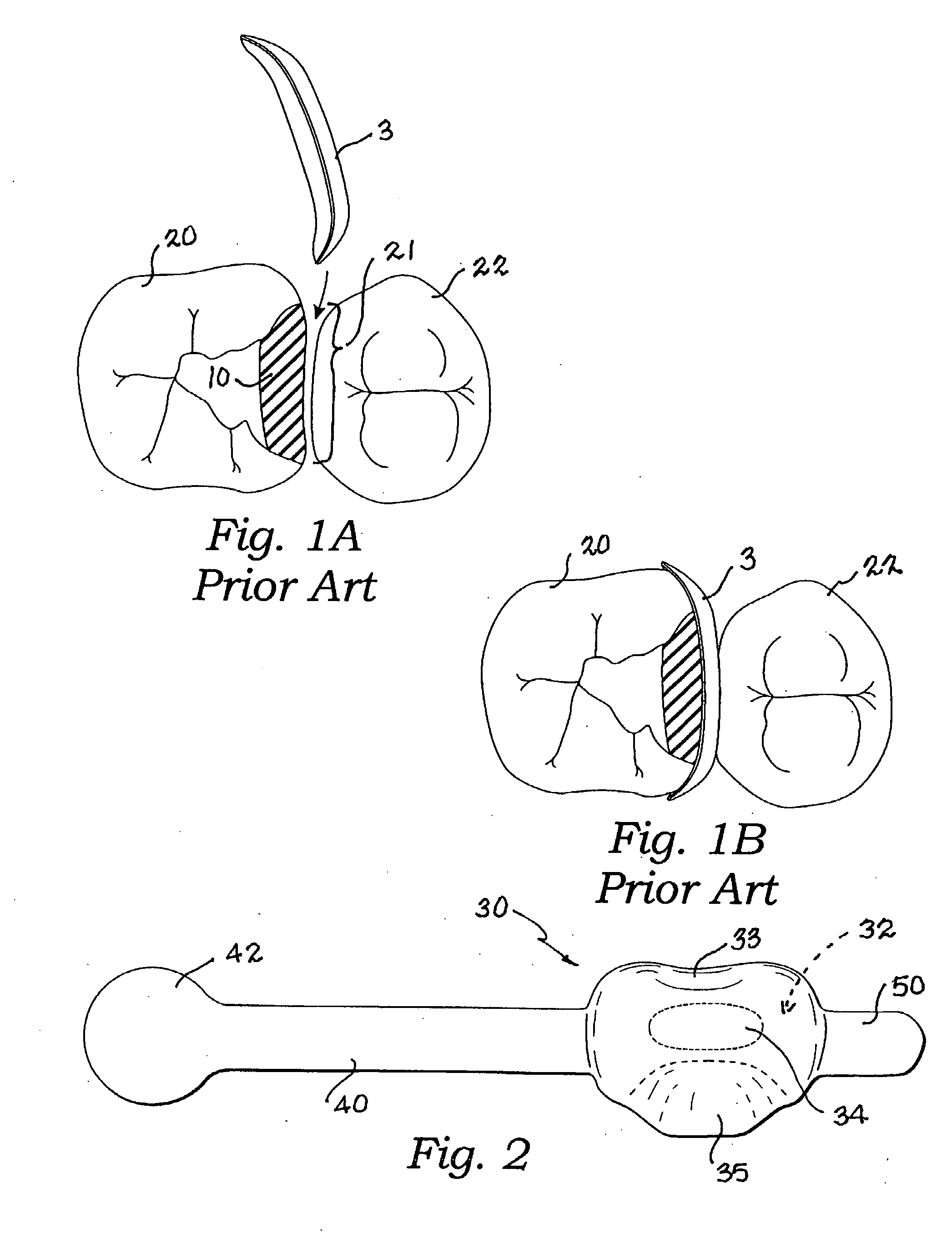 Dental matrix for a class II, III or IV restoration