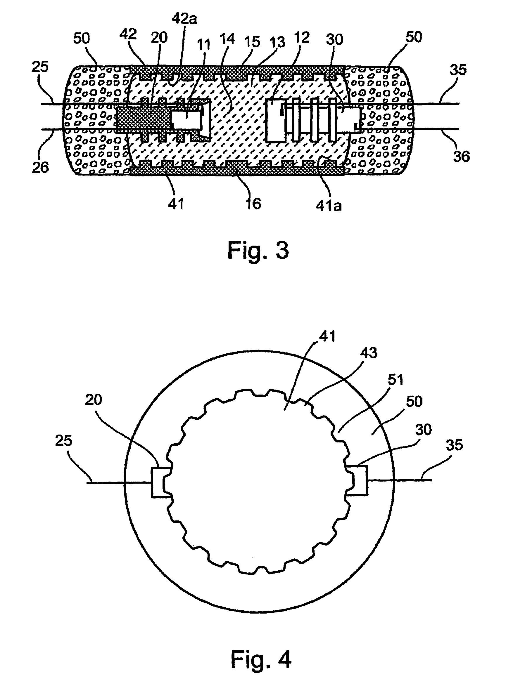 High-sensitivity sensors for sensing various physiological phenomena, particularly useful in anti-snoring apparatus and methods